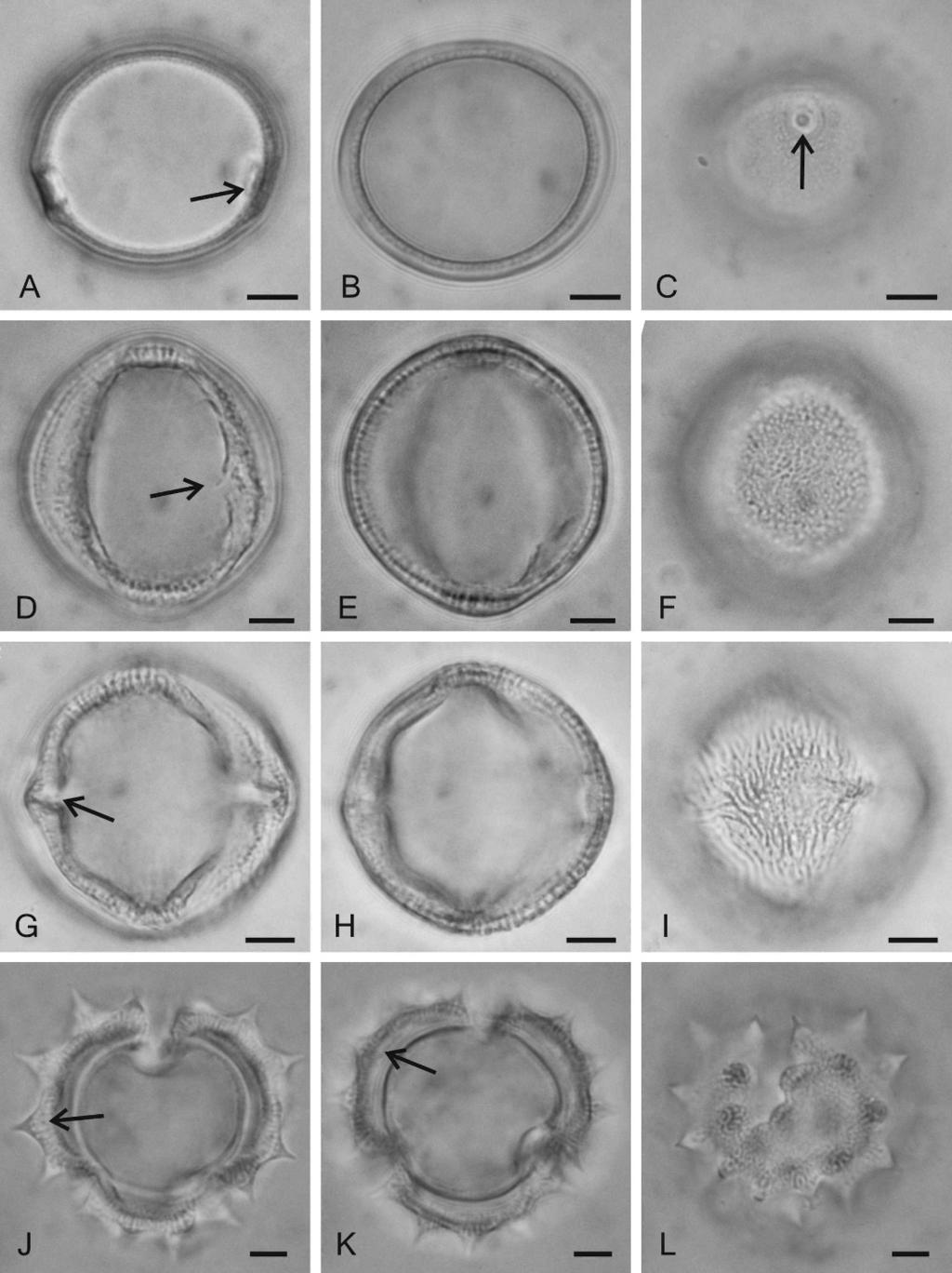 2007] PALAZZESI ET AL.: POLLEN OF SOUTH AMERICAN SPECIES 529 FIG. 1. LM photomicrographs of the selected species of this study: (A C) Equatorial view of Celtis tala. A. High focus showing circular ora (arrow).