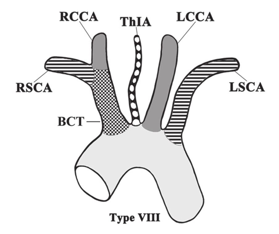 G. Vučurević et al., Aortic branch variations Figure 10. A drawing showing the aortic origin of the thyroidea ima artery (ThIA); rest abbreviations as in Table 2.