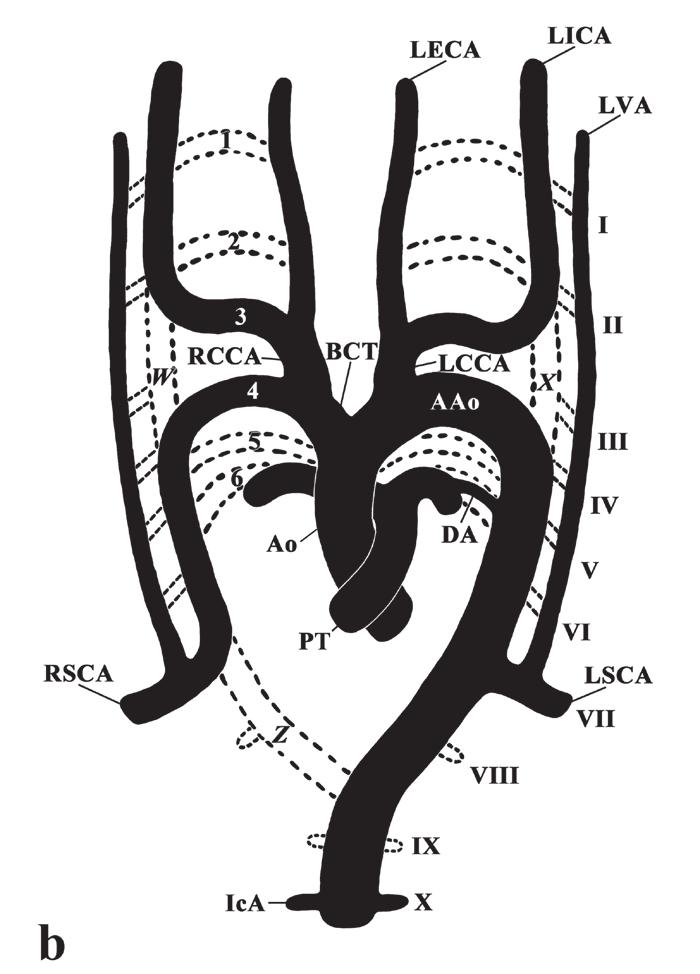 pulmonary trunk (PT) and aorta (Ao) with its arch (AAo), interconnected by the ductus arteriosus (DA), as well as the brachiocephalic trunk (BCT), the right and left common carotid arteries (RCCA and
