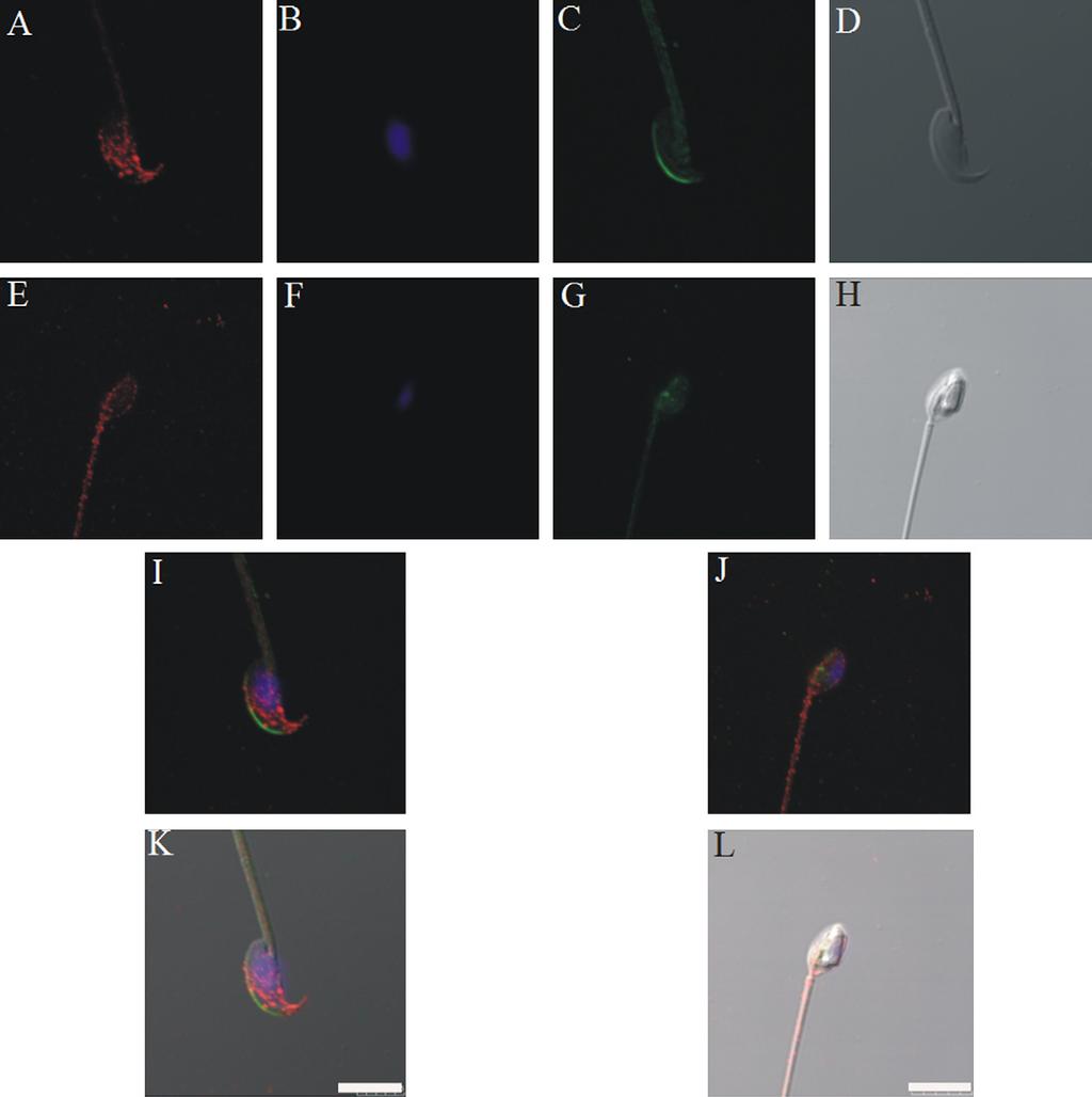 PLCf in spermatozoa and testis from the wobbler mouse 745 Results PLCf analysis To determine whether PLCf protein expression or localization in spermatozoa is abnormal in the wobbler mouse strain,