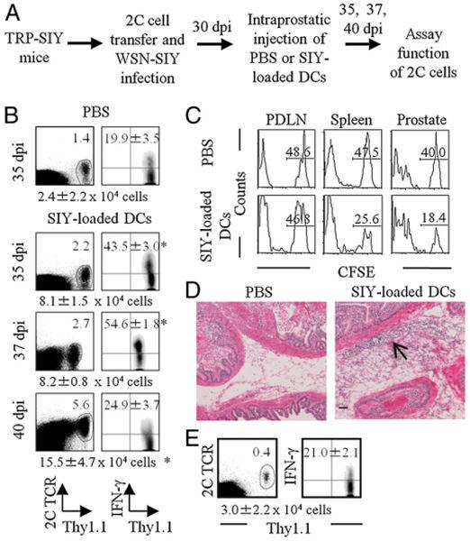 Higham et al. Page 10 FIGURE 3. Intraprostatic injection of Ag-loaded DCs reactivates persisting tolerized T cells in the prostate tumor tissue.
