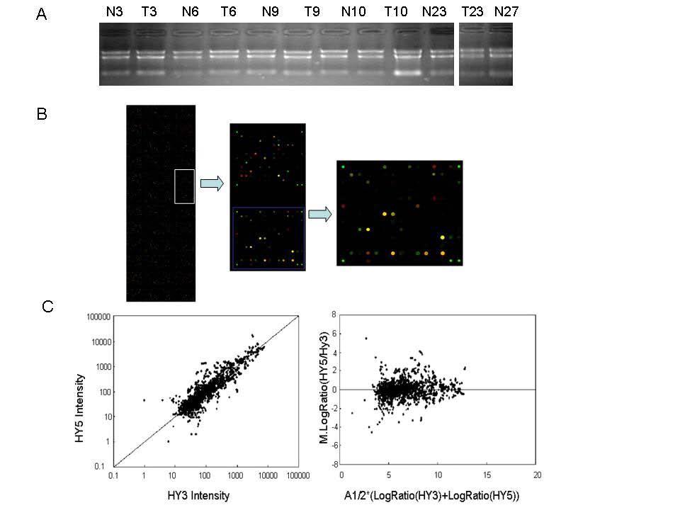 ONCOLOGY REPORTS 26: 1431-1439, 2011 1433 Figure 1. mircury LNA array analyzes of mirna gene expression profile of intestinal-type gastric cancer and normal tissues.