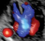 Echocardiography: Normal and