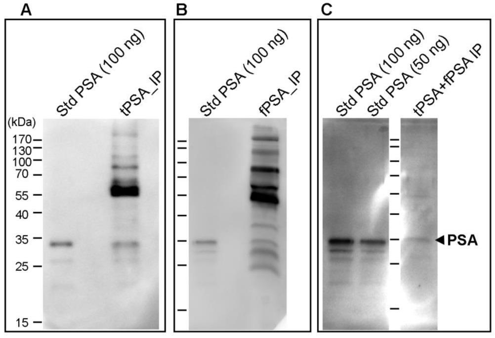 1197 Figure 2: Immunodetection of core fucosylated glycoproteins by Western blot with PhoSL lectin following PSA immunoprecipitation (IP).
