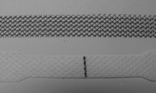 FIGURE 1. (Top) TVT macropore, elastic polypropylene tape. (Bottom) Mentor ObTape micropore, inelastic tape.