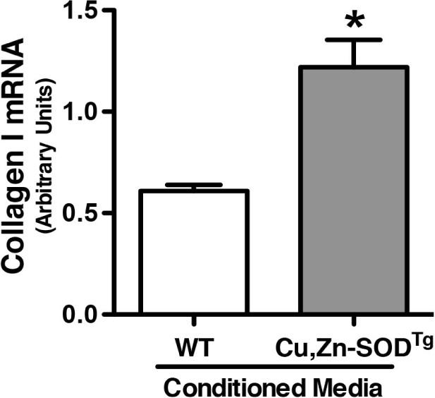 as seen in the Cu,Zn-SODTg mice TGF- is an important marker of M2-phenotype macrophages, and its