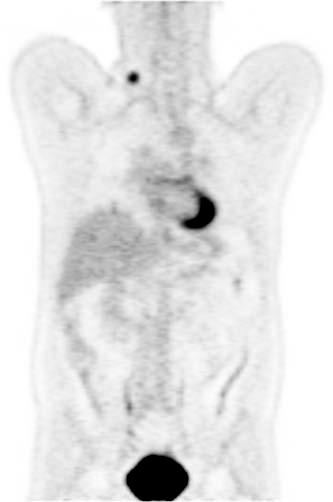 Imaging FDG uptake (PET) with anatomical