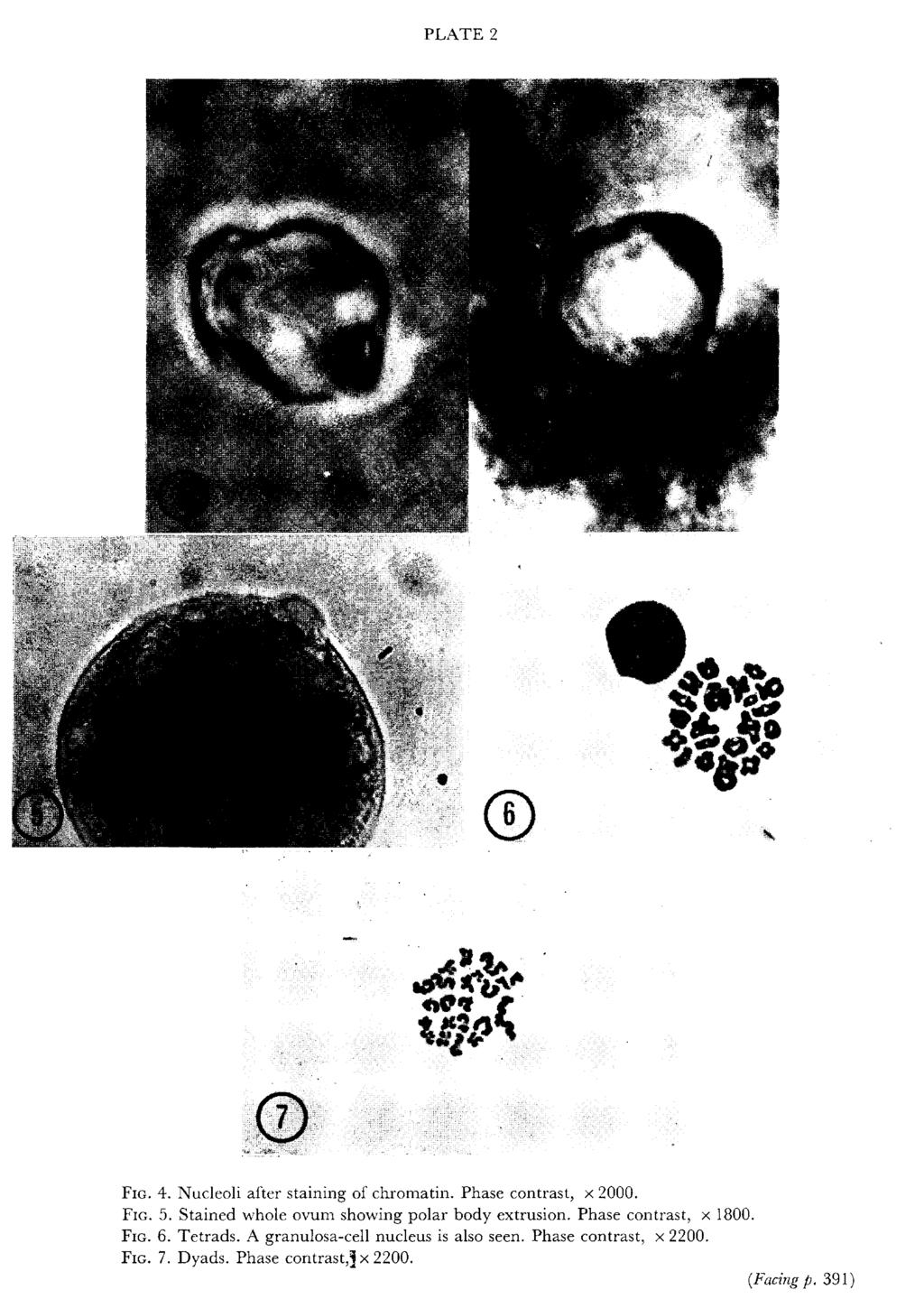 PLATE Fig. Fig. Fig. Fig. 4. Nucleoli after staining of chromatin.