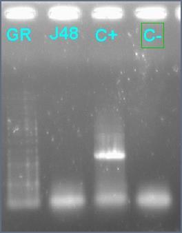 RNA was extracted from frozen plasma using the QIAmp Viral RNA Mini Kit, and cdna was synthesized with RevertAid enzymes using BF_EnvR3 as the primer. First-round PCR was then done. Figure 3.