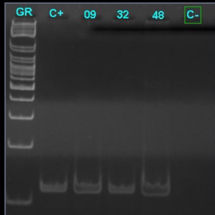 To check whether the extraction was successful, the existing primer pairs for the p24 region were used in one-step PCR. Figure 6. One-Step PCR of p24 Gene.