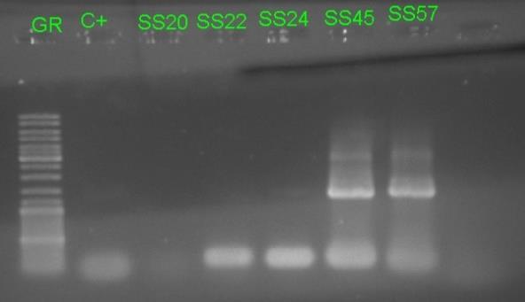 RNA was extracted from the frozen plasma samples DRSS 20, DRSS 22, DRSS 24, DRSS 45, DRSS 57, DRHS 07, DRSS 64, and DRSS 66. C- Figure 8. One-step PCR of Five New Samples.