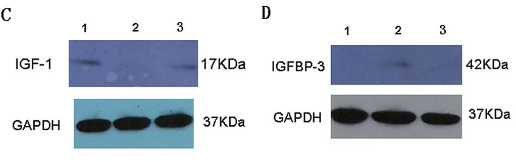 2 3 A B C D Quantitative real time-pcr and Western blot analyses of IGFBP-3 and IGF-1 mrna and protein levels