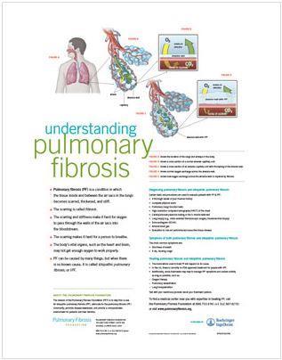 Understanding PF posters * Physician notepads * Webinars + DVD s * * Available