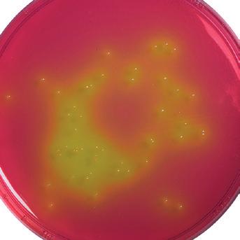 Salmonella. HP008 Indicative Salmonella on XLD Agar are red colonies with or without black centres. Salmonella are able to ferment xylose to produce acid but not lactose or sucrose.