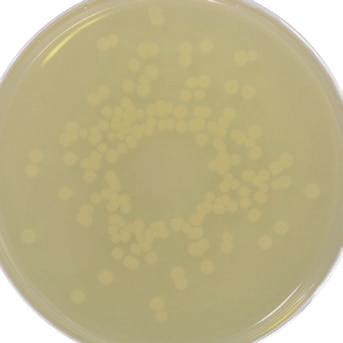 HP015 Typical Aspergillus brasiliensis growth on Potato Dextrose Agar. The extract from potato and dextrose provide a nutritionally rich base that encourages mould sporulation and pigment production.