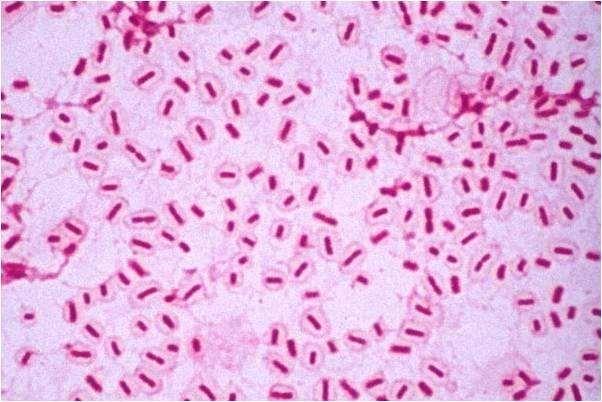 GENUS KLEBSIELLA Genus Features Members of the genus Klebsiella are capsulated Gram-negative rods. They are non-motile but some strains express fimbriae.