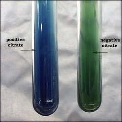 the medium from green to blue. It is important to use a light inoculum because dead organisms can be a source of carbon, producing a false-positive reaction (Figure 4).
