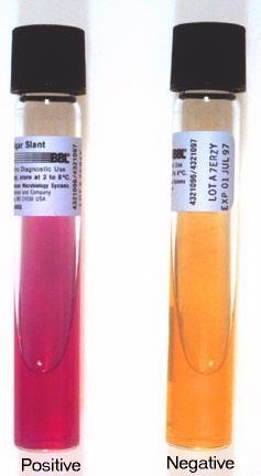Urea conversion Urea agar slants are used to test whether bacteria can convert urea into ammonia and carbon dioxide.