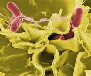Salmonella enteritidis Sign and symptoms Fever, diarrhea, vomiting, and abdominal