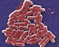 EIEC The causative agent Escherichia coli Sign and symptoms Severe bloody diarrhea, with mucus containing PMN s Toxin involved No toxin, but the intestinal wall is severely damaged through