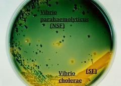 Thiosulfate-citrate-bile salts-sucrose agar Vibrio selective and differential agar Bile selects for enteric bacteria Thiosulfate and citrate inhibit growth of enterobacteriaeceae Thiosulfate and
