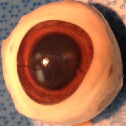 Intraocular Pressure Results For the gelatin eyes, 70% of the time IOP decreased over the course of 48 hours.