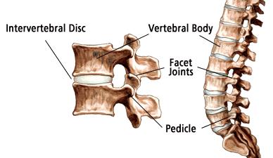 Augmented vertebral bodies help to restore function.