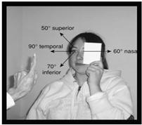 )Use the Four vital signs to determine how to best triage the patient TRIAGE EYE EMERGENCIES Prompt