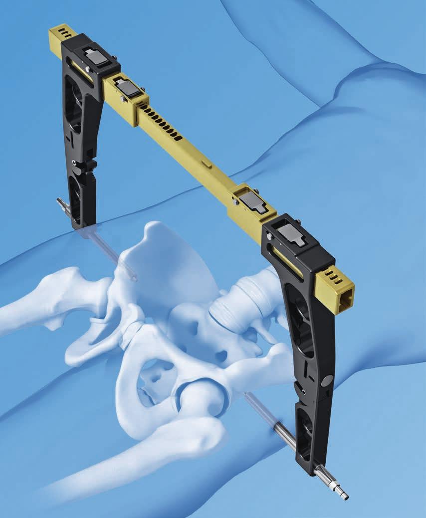Pelvic C-Clamp. Emergency stabilization instrument for unstable injuries and fractures of the pelvic ring.