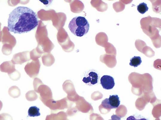 Hemopoiesis occurs in red bone marrow ( see chapter 6). The process starts with hemopoietic stem cells called hemocytoblasts (he -mo sı to -blast) (figure 21.11).