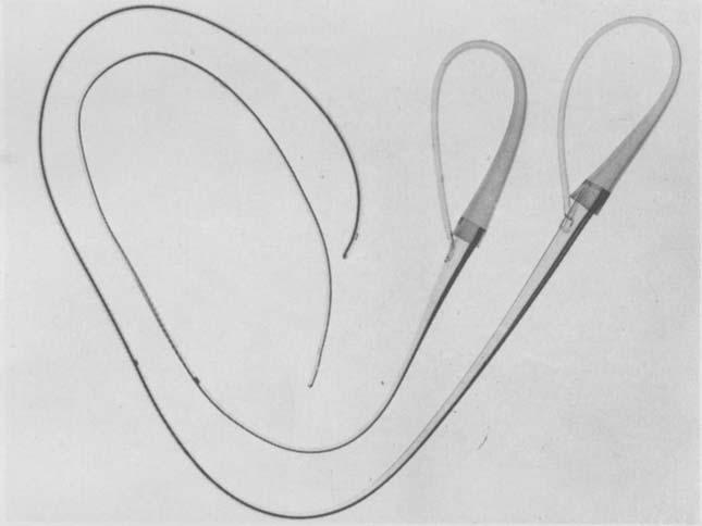 329 Ludington et al: Soft Flexible Catheter Stents in Coronary Bypass Fig 1. Six 3.5 orid 5F soft, fle.xible argyle catheters.