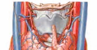 Intra operative findings: INTRAOPERATIVE 2 cm perforation at the left laryngopharyngeal area just