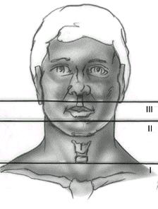 Zones of the Neck: ZONE I from cricoid cartilage to the clavicle ZONE II from angle of the