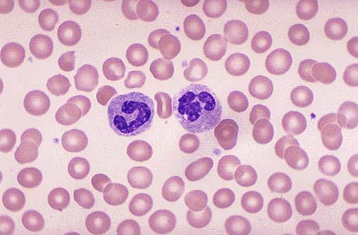 hemoglobin Transport oxygen Red blood cells normally
