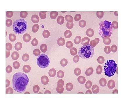 Types of White Blood Cells - What s the Diff?