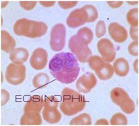 WBC Differential: Eosinophils Possible Causes of Eosinophilia: Decreased Levels: Common: allergic disorders (including drug reactions) Uncommon: parasite infection, lupus, rheumatoid