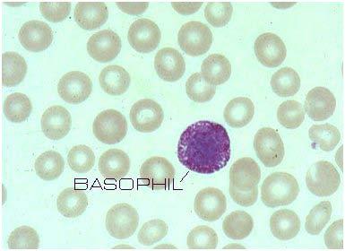 WBC Differential: Basophils Possible Causes of Basophilia: Decreased Levels: Rare: