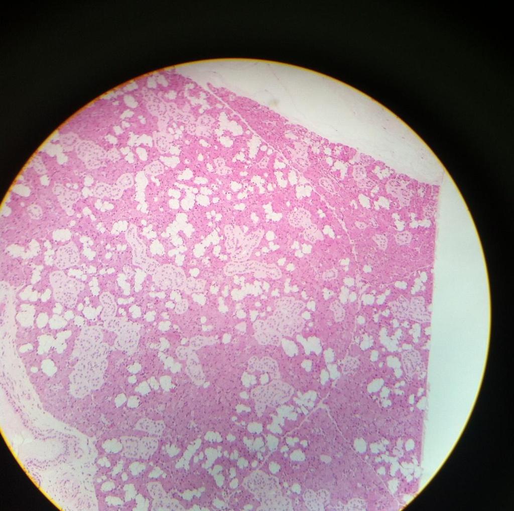 Submandibular Gland Section 1 - White: mucus acini. -Dark purple: Serous acini.