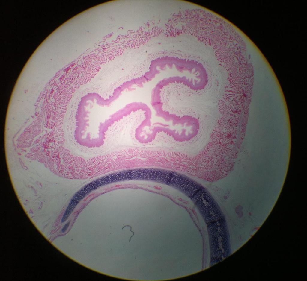 Transverse Section of Esophagus (upper part) Trachea Mucosa: Star shaped and closed lumen until deglutition of bolus Submucosa *Esophagus is posterior to trachea Type