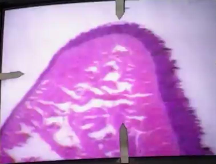 Tongue Ventral surface of the tongue (nonkeratinized stratified squamous epithelium) connected to floor of mouth by loose connective tissue.