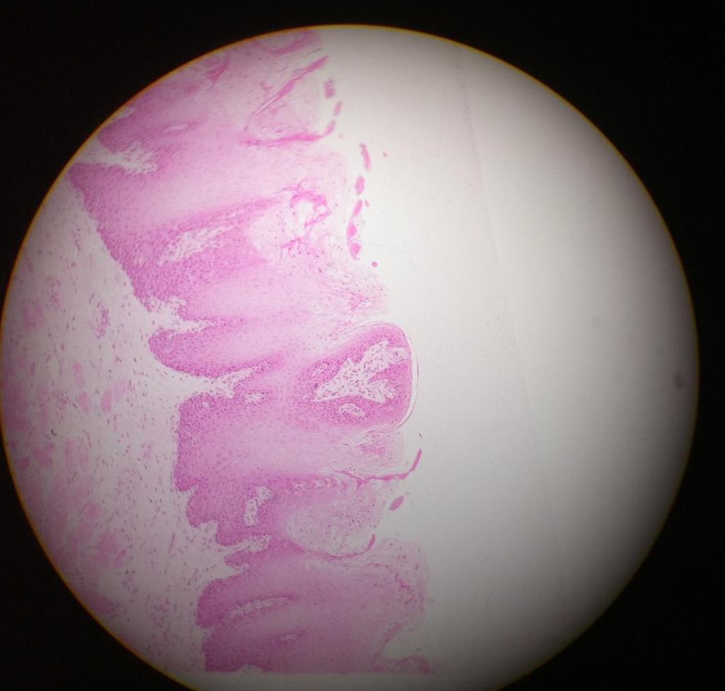 Fungiform Papillae Connective Tissue Papillae projecting into the fungiform
