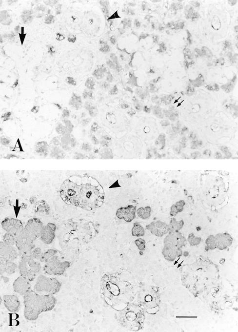 892 Liu, Fujitani, Koda, Soejima, Kimura Figure 3 Immunohistochemical staining of the submandibular gland from an A secretor by anti-h MBr1 (A) and by anti-a (B).