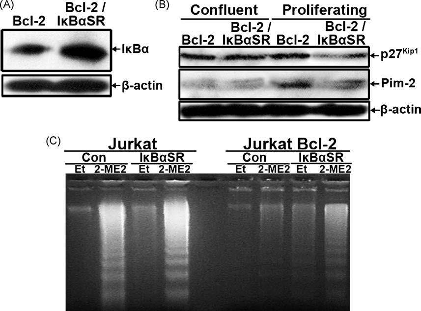 40 C. Batsi et al. / Biochemical Pharmacology 78 (2009) 33 44 Fig. 7. Suppression of NF-kB signaling pathway in Jurkat cells.