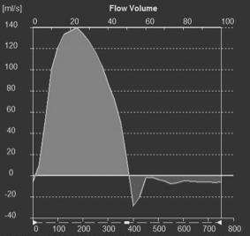 9 l/min 52/81 = 64% 54/78 = 69% Flow sensitive 4D MRI PC MRI sequences