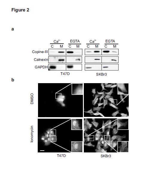 5. Copine III and ErbB2-mediated migration Figure 5-2 Copine III localizes to membranes in a Ca2+-dependent manner (a) T47D and SKBr3 cells were incubated in buffer containing either CaCl 2 or EGTA,