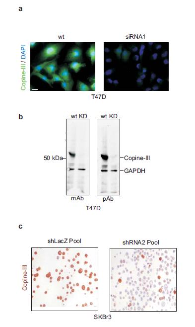 5. Copine III and ErbB2-mediated migration Figure 5-3 Specificity of the α-copine III monoclonal antibody (a) Copine III was visualized with the monoclonal antibody using immunofluorescence