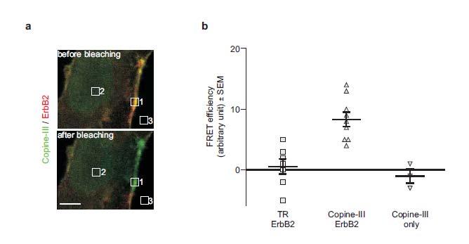 5. Copine III and ErbB2-mediated migration Figure 5-6 FRET acceptor photobleaching shows the interaction of Copine III and ErbB2 at the plasma membrane SKBr3 cells were starved overnight and