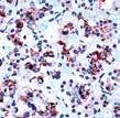 1 Clone: EPR3158Y Renal Cell Carcinoma (gp200) Clone: SPM487 Retinoblastoma (Rb)