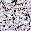 They are provided in a 16 ml format. Concentrated antibodies: To ensure highest flexibility in your immunohistochemistry protocol Zytomed Systems offers 1 ml, 0.5 ml and 0.