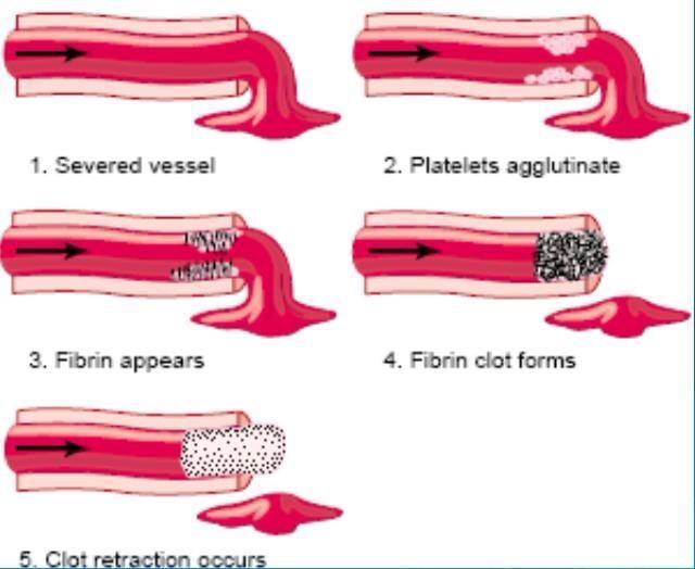 Fibrous Organization of the Blood Clot Once a blood clot has formed, it can follow one of two courses: (1) It can become